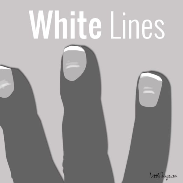  White Lines Across Nails