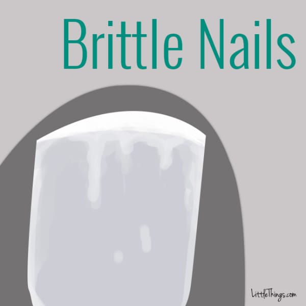 Brittle, Crumbly Nails