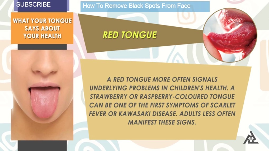 Red Tongue for kids :