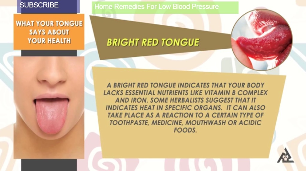 So, what does your tongue say about your health? Lets start out with : Bright Red Tongue 