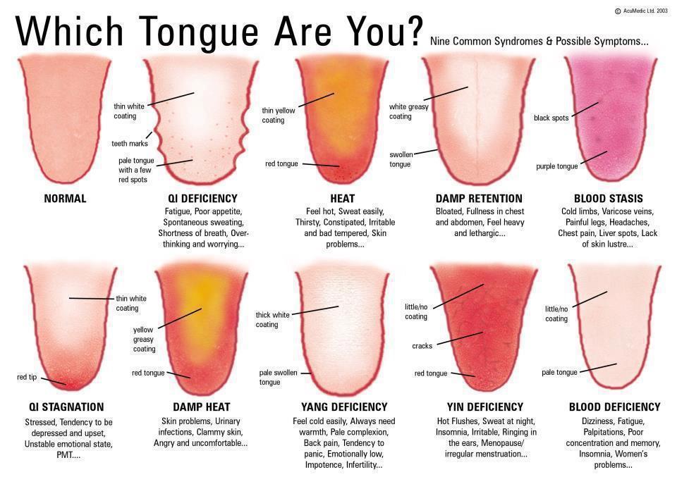 Which Tongue are you?