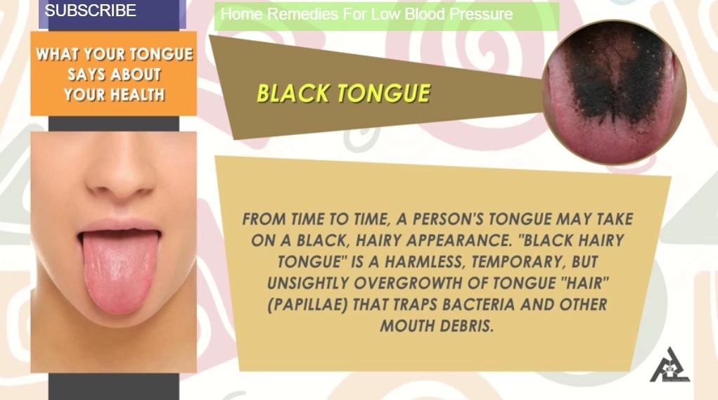 Black Tongue: